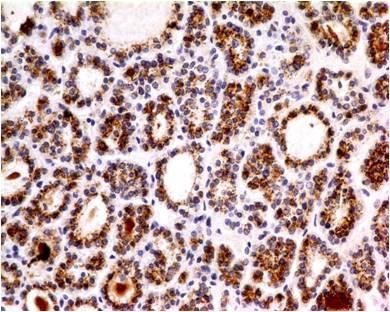 Anti-Parathyroid Hormone (Clone: ABM4D44)