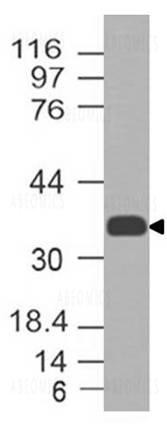 Anti-CCR2 (Clone: ABM58F2)