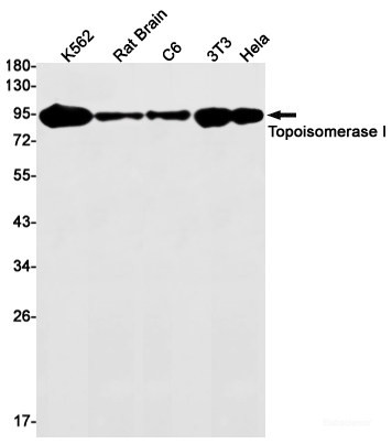 Anti-Recombinant Topoisomerase I, clone R02-2H9
