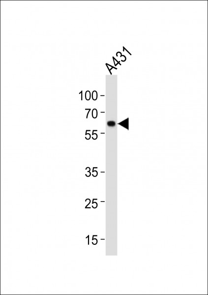 Anti-Hsp60