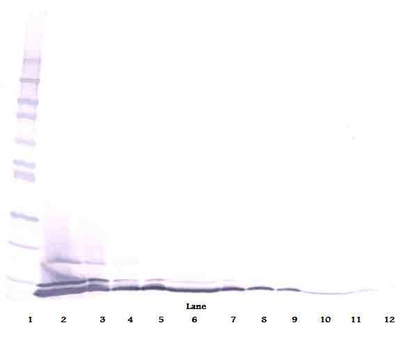 Anti-Eotaxin-3