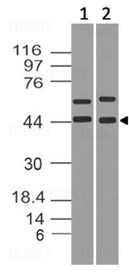 Anti-IkB alpha (Clone: ABM10F4)