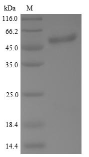 Cellular tumor antigen p53 (TP53), human, recombinant