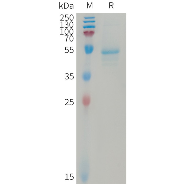 Human IL23A and IL12B Heterodimer Protein, hFc Tag and His Tag