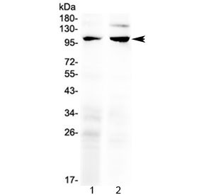 Anti-TRPC6