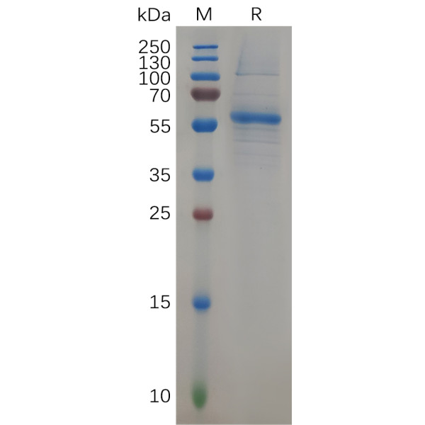 Human KRAS Protein, hFc Tag