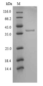 Tyrosine-protein kinase JAK1 (JAK1), partial, human, recombinant