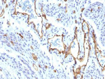 Anti-CD31 / PECAM-1 (Endothelial Cell Marker) (clone: C31/1395R) (recombinant rabbit monoclonal)