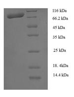 Calpain-1 catalytic subunit (CAPN1), human, recombinant