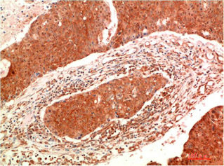 Anti-JAK2 Monoclonal