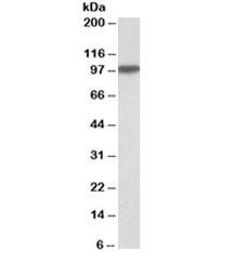 Anti-Aconitase 1