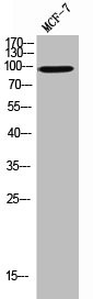 Anti-CD36