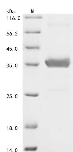 Free fatty acid receptor 3 (FFAR3), partial, human, recombinant