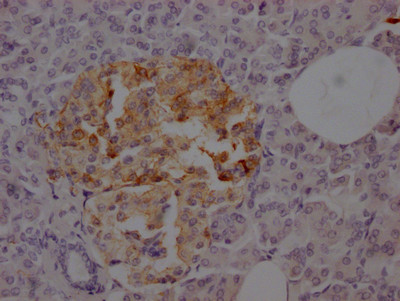 Anti-SSTR2 Recombinant Monoclonal, clone 1C3