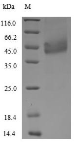 Tumor necrosis factor receptor superfamily member 13C (TNFRSF13C), partial (Active), human, recombin