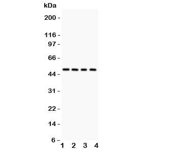 Anti-Alpha 1 Antitrypsin