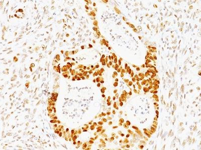 Anti-p53 Tumor Suppressor Protein(Clone: TRP/817)
