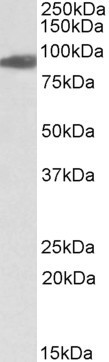 Anti-Aconitase 2 (aa541-555), Internal