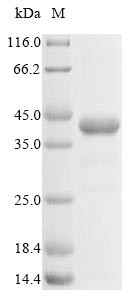 HLA class I histocompatibility antigen, alpha chain E (HLA-E),partial, human, recombinant