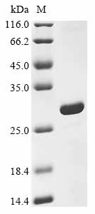 NAD-dependent protein deacetylase sirtuin-3, mitochondrial (SIRT3),partial, human, recombinant