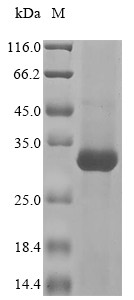 Ceruloplasmin (CP), partial, human, recombinant