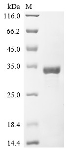 CCR4-NOT transcription complex subunit 7 (CNOT7), human, recombinant