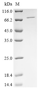 Poly [ADP-ribose] polymerase 2 (PARP2), human, recombinant