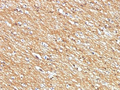 Anti-CD56 / NCAM1 / NKH1 (Neuronal Cell Marker)(Clone: NCAM1/795)
