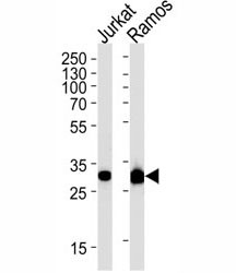 Anti-Caspase-3, clone 1262CT521.280.101