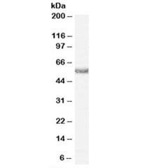 Anti-Histamine receptor H1