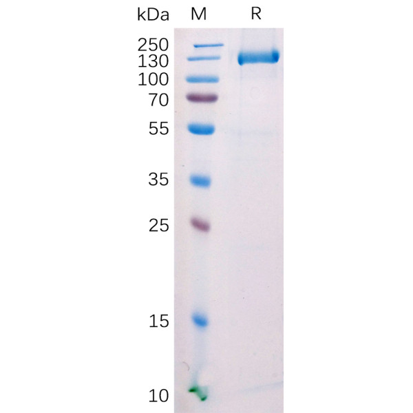 Mouse FAP Protein, C-mFc Tag