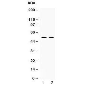 Anti-CHRNA5