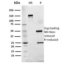 Anti Fn1 Fibronectin Clone Fn 3 Nsj Bioreagents Biomol Com