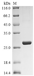 Retinol-binding protein 4 (Rbp4), rat, recombinant