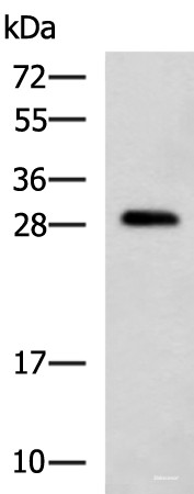 Anti-CMTM2