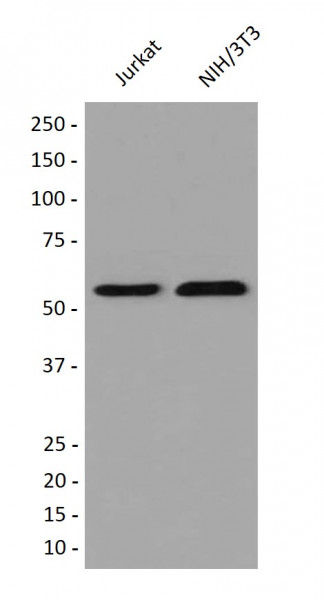 Anti-Thioredoxin Reductase 1