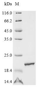 Apoptosis-associated speck-like protein containing a CARD (PYCARD), Partial, human, recombinant