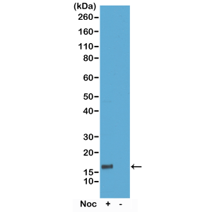 Anti-Phospho-Histone H3 (Thr6), Rabbit Monoclonal (RM160)