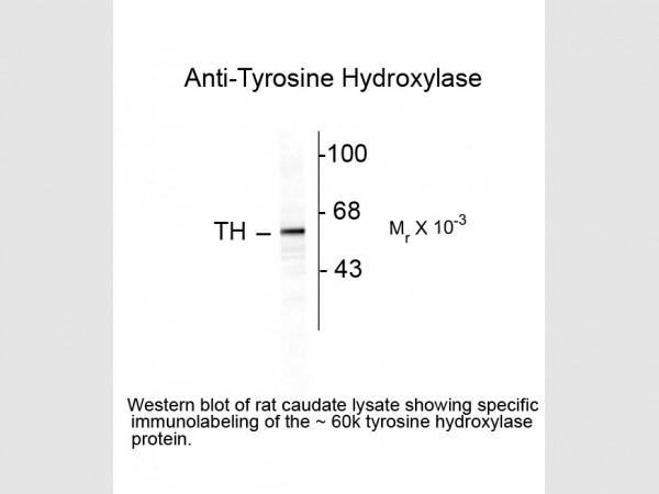 Anti-Tyrosine Hydroxylase