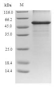 Alanine aminotransferase 1 (GPT), human, recombinant