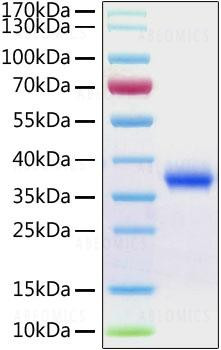 Recombinant 2019-nCoV Spike RBD Protein His tag