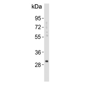 Anti-KLK6 / Kallikrein 6