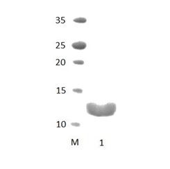 PDZRN3_1 PDZ Domain