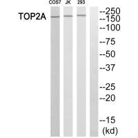 Anti-TOP2A