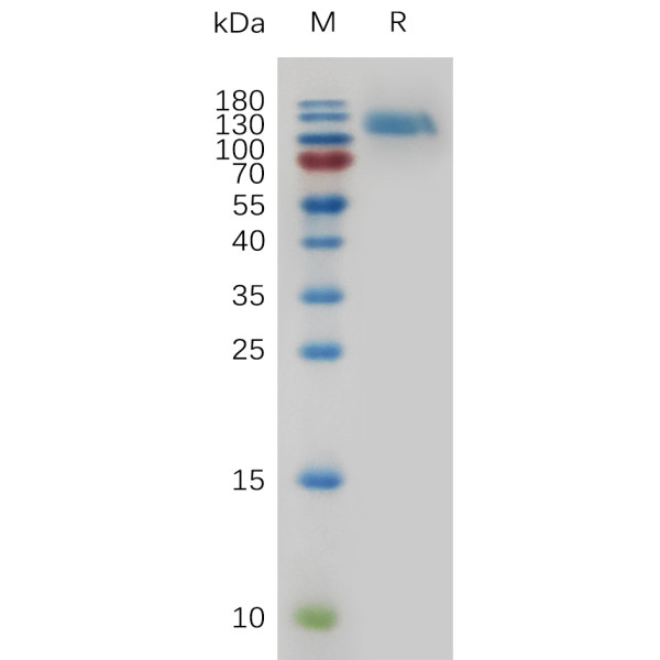 Mouse EGFR Protein, His Tag