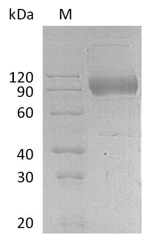 Interleukin-17 receptor A (IL17RA), partial (Active), human, recombinant