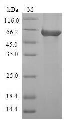 Carbonic anhydrase-related protein (CA8), human, recombinant