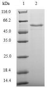 Transcriptional enhancer factor TEF-3 (TEAD4), partial, human, recombinant