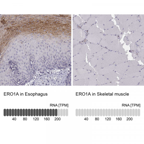 Anti-ERO1A