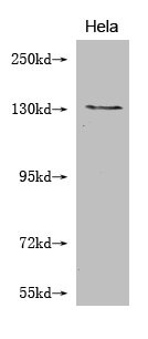 Anti-NOS2 Monoclonal, clone 2H6B10